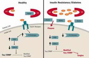 insulin_resistance