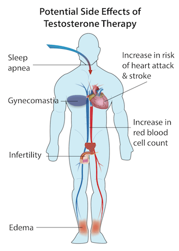 Side-Effects-of-Testosterone-Therapy.png