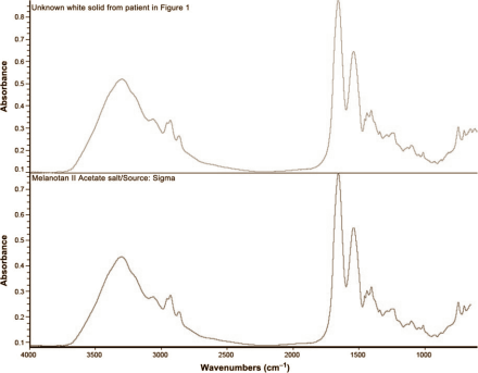 melanotan2toxicity.gif
