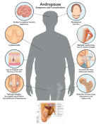 andropause