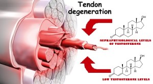 ankle_peroneal_tendinitis_causes03