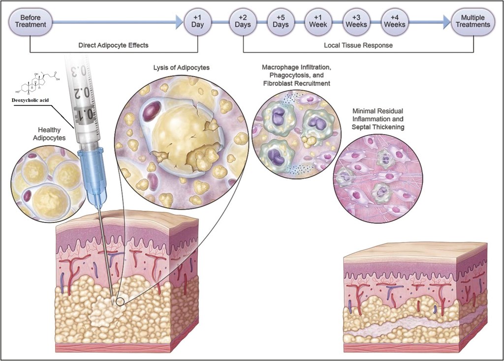 JCutanAesthetSurg_2018_11_2_67_240028_f1