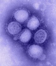 800px-H1N1_influenza_virus