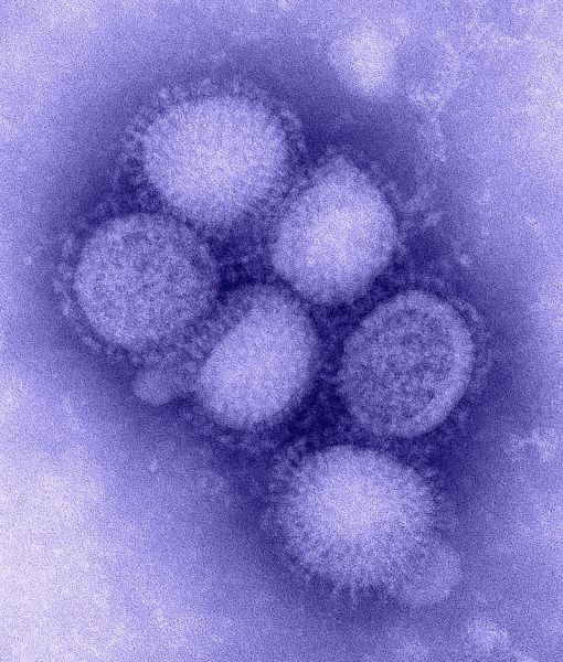 800px-H1N1_influenza_virus