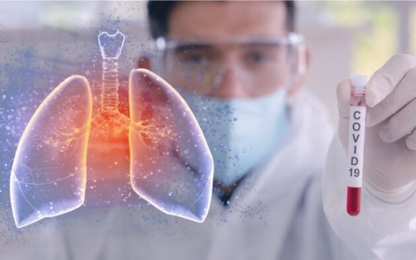 diagnosi-di-covid-19_w630