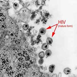 hiv-virus