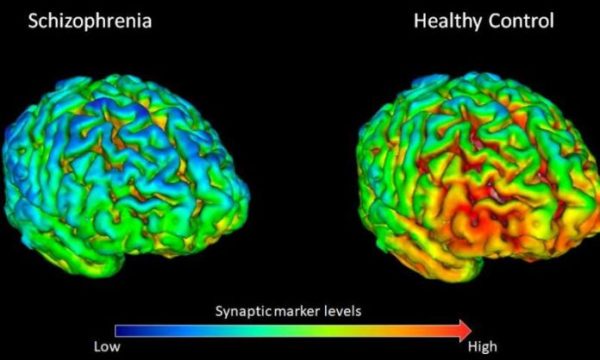 newstudyfind-696x418